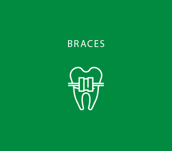 Braces
